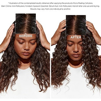 Kerastase Symbiose Intensive Anti-dandruff Cellular Night Serum 90ml